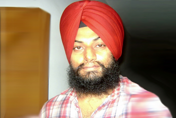moustache transplant 800 grafts