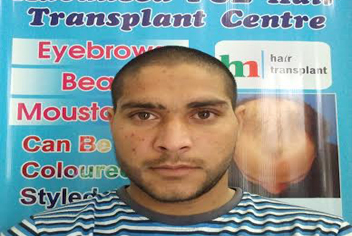 French cut beard