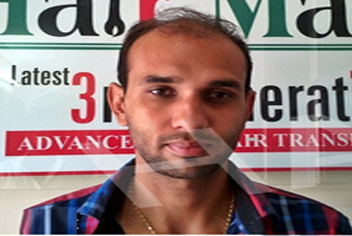 initial condition of patient in type 3 baldness