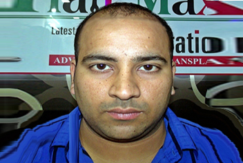 initial condition of patient in type 3 baldness